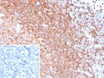 CXCR5/CXCL13/CD185 Recombinant Rabbit Monoclonal Antibody (CXCR5/8279R)