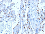 Peripherin/PRPH (Marker of Peripheral Neurons) Recombinant Mouse Monoclonal Antibody (rPJM50)