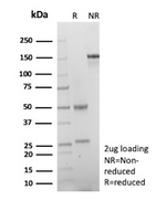 Peripherin/PRPH (Marker of Peripheral Neurons) Antibody in SDS-PAGE (SDS-PAGE)