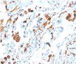 Pulmonary Surfactant-Associated Protein D (SFTPD) Monoclonal Antibody (SFTPD/4363)