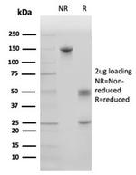 Pulmonary Surfactant-Associated Protein D (SFTPD) Antibody in Immunoelectrophoresis (IE)