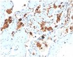 Pulmonary Surfactant-Associated Protein D (SFTPD) Monoclonal Antibody (SFTPD/4363)