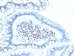 BMI1 Monoclonal Antibody (BMI1, 2689)