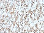 Interleukin-25 (IL-25)/IL-17E Monoclonal Antibody (IL25/625)