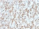 Interleukin-25 (IL-25)/IL-17E Monoclonal Antibody (IL25/625)
