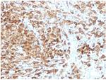gp100/Melanosome/PMEL17/SILV (Melanoma Marker) Antibody in Immunohistochemistry (Paraffin) (IHC (P))