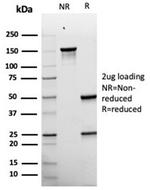 gp100/Melanosome/PMEL17/SILV (Melanoma Marker) Antibody in SDS-PAGE (SDS-PAGE)