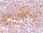 gp100/Melanosome/PMEL17/SILV (Melanoma Marker) Monoclonal Antibody (NKI-beteb)