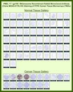 gp100/Melanosome/PMEL17/SILV (Melanoma Marker) Antibody in Immunohistochemistry (Paraffin) (IHC (P))