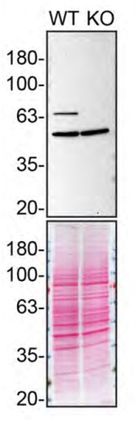 Rabbit IgG (H+L) Secondary Antibody in Western Blot (WB)