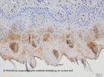 Ep-CAM Antibody in Immunohistochemistry (IHC)