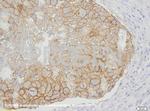 Ep-CAM Antibody in Immunohistochemistry (IHC)