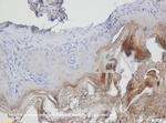 Ep-CAM Antibody in Immunohistochemistry (IHC)