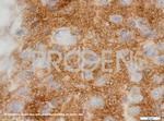 Synaptophysin Antibody in Immunohistochemistry (IHC)