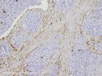 Vimentin Antibody in Immunohistochemistry (IHC)
