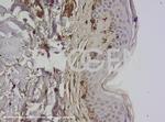 Vimentin Antibody in Immunohistochemistry (IHC)