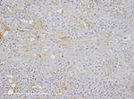 Vimentin Antibody in Immunohistochemistry (IHC)