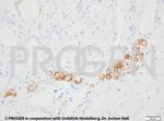 Cytokeratin 7 Antibody in Immunohistochemistry (IHC)