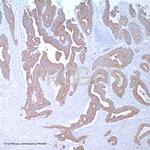 Cytokeratin 20 Antibody in Immunohistochemistry (IHC)