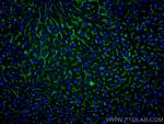 CD105 Antibody in Immunohistochemistry (Paraffin) (IHC (P))
