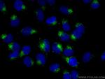 CD107a Antibody in Immunocytochemistry (ICC/IF)