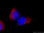 CD107b/LAMP2 Antibody in Immunocytochemistry (ICC/IF)