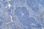 Foxp3 Antibody in Immunohistochemistry (Paraffin) (IHC (P))