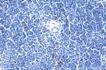 Foxp3 Antibody in Immunohistochemistry (Paraffin) (IHC (P))