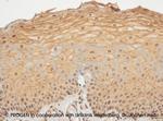 Desmoglein 1 Antibody in Immunohistochemistry (IHC)