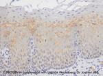 Desmoglein 3 Antibody in Immunohistochemistry (IHC)