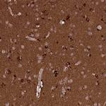 delta Catenin Antibody in Immunohistochemistry (IHC)