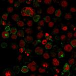 GLUT-1 Monoclonal Antibody (GLUT1, 2475)