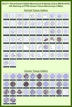 GLUT-1 (Tumor Progression and Mesothelioma Marker) Recombinant Rabbit Monoclonal Antibody (MSVA-401R)