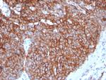 GLUT-1 Recombinant Rabbit Monoclonal Antibody (GLUT1, 3132R)