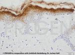 KRT2 Antibody in Immunohistochemistry (IHC)