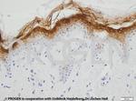 KRT2 Antibody in Immunohistochemistry (IHC)