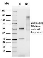 Smoothelin (Differentiated Smooth Muscle Marker) Antibody in SDS-PAGE (SDS-PAGE)