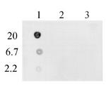 DNA-RNA Hybrid Antibody in Dot Blot (DB)