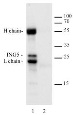 ING5 Antibody in Immunoprecipitation (IP)