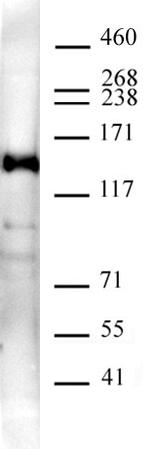 Supt5H/SPT5 Antibody in Western Blot (WB)