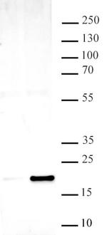 Histone H3K14ac Antibody in Western Blot (WB)