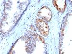 SLC18A2 Monoclonal Antibody (SLC18A2/7983)