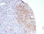 Somatostatin receptor type 2 (SS2R)/SSTR2 Monoclonal Antibody (SSTR2/7532)