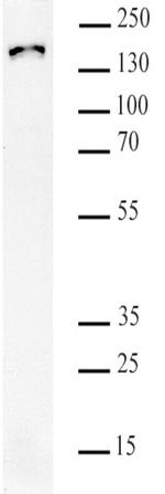 SMC3 K105acK106ac Antibody in Western Blot (WB)