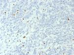 BRG1/SMARCA4 Recombinant Rabbit Monoclonal Antibody (BRG1/6531R)