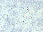 BRG1/SMARCA4 Recombinant Rabbit Monoclonal Antibody (BRG1/7633R)