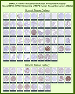 BRG1/SMARCA4 Recombinant Rabbit Monoclonal Antibody (MSVA-397R)