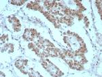 Integrase interactor 1 (INI-1)/SNF5/SMARCB1 Recombinant Rabbit Monoclonal Antibody (rINI1/8850)