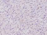 Integrase interactor 1 (INI-1)/SNF5/SMARCB1 Monoclonal Antibody (rSMARCB1/4588)