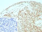 Integrase interactor 1 (INI-1)/SNF5/SMARCB1 Recombinant Rabbit Monoclonal Antibody (INI1/8935R)